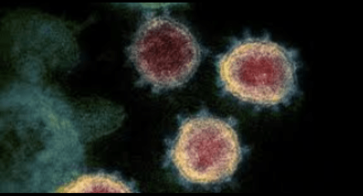 Per 26 April Total 129 Kasus Positif Covid 19 di Sumsel