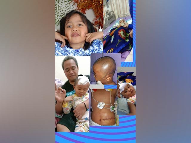 penonjolan pembuluh darah otak