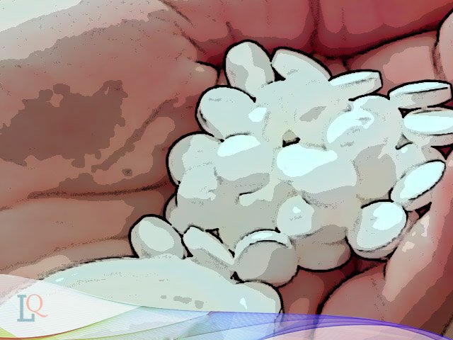 Beli Obat Terlarang, obat terlarang jenis psikotropika