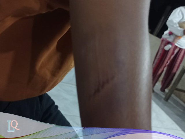 dugaan tindak pidana pengeroyokan